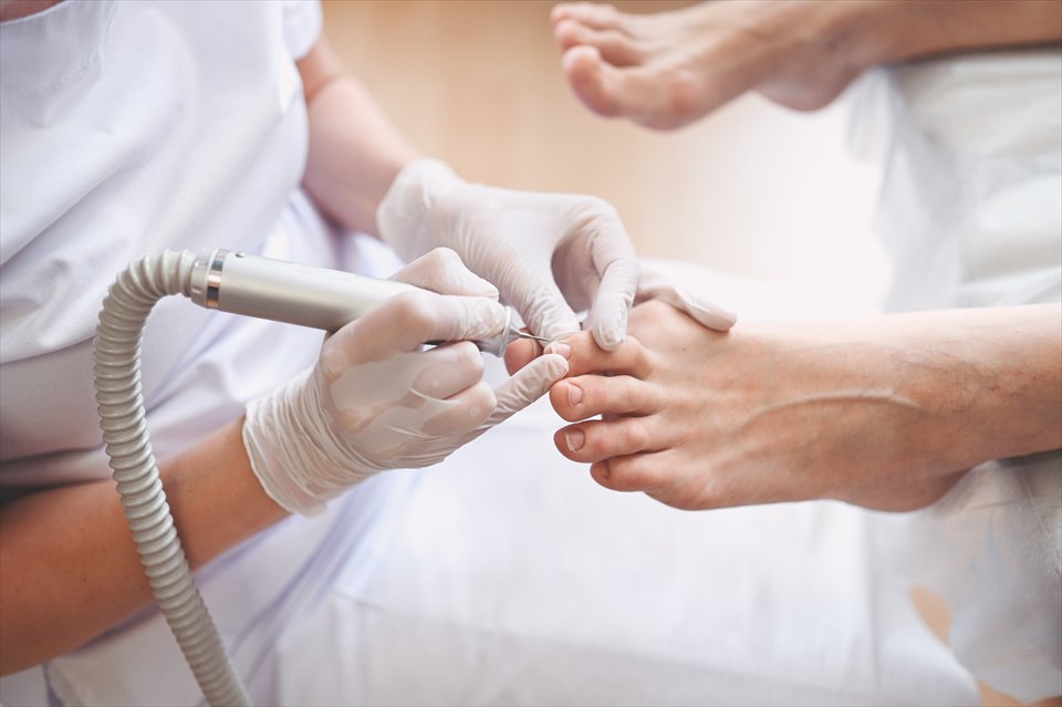 Podologische Behandlung eines Fußnagels mit einem medizinischen Instrument